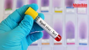 의료기관에 '치사율 40~75%' 니파 바이러스 예방조치 지시