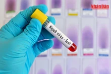 의료기관에 '치사율 40~75%' 니파 바이러스 예방조치 지시