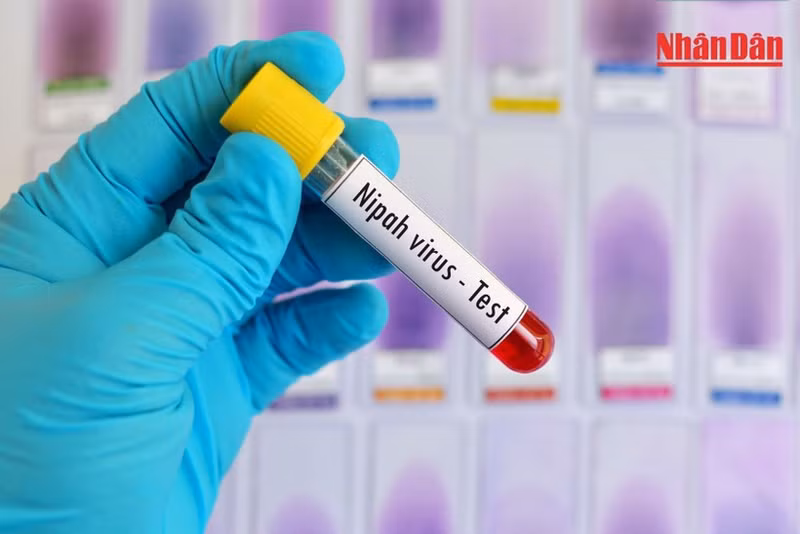 의료기관에 '치사율 40~75%' 니파 바이러스 예방조치 지시